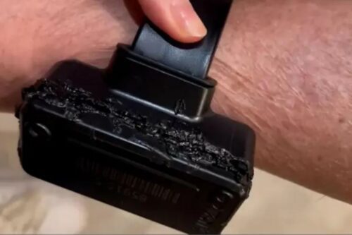 Close-up mostrando um dispositivo de monitoramento eletrônico (tornozeleira eletrônica) preto, parcialmente derretido e danificado na lateral, preso ao tornozelo de Bolsonaro.